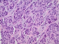 breast-pathology2.jpg