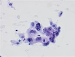 cytopathology2.jpg