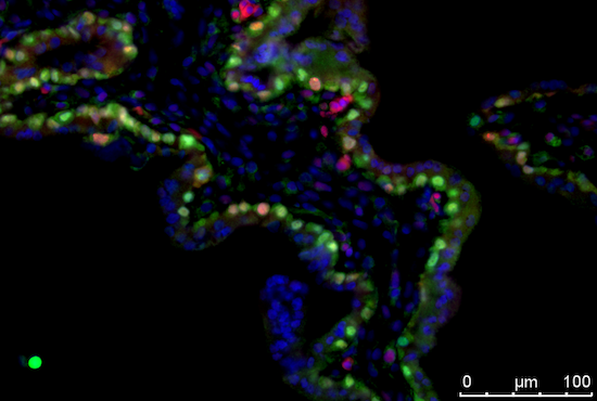 VGLL1 PCNA placenta